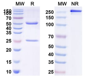 SDS-PAGE - Anti-ASGR1 Antibody [SBT823] Biosimilar - BSA and Azide free (A339353) - Antibodies.com