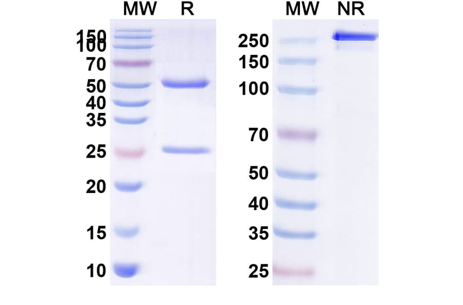 SDS-PAGE - Anti-ASGR1 Antibody [SBT823] Biosimilar - BSA and Azide free (A339353) - Antibodies.com
