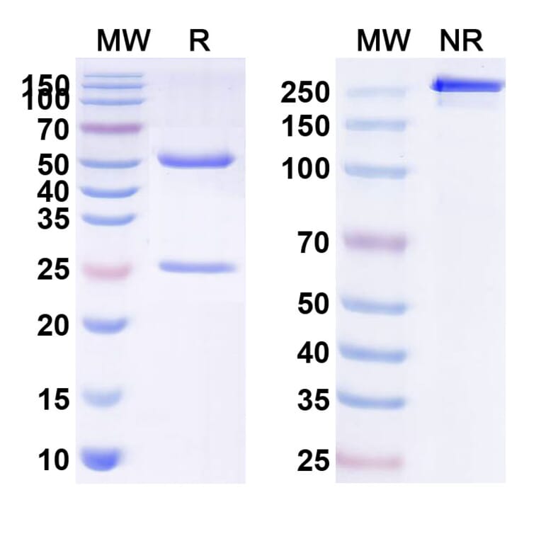 SDS-PAGE - Anti-ASGR1 Antibody [SBT823] Biosimilar - BSA and Azide free (A339353) - Antibodies.com