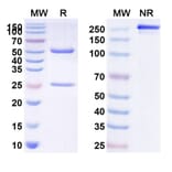 SDS-PAGE - Anti-ASGR1 Antibody [SBT823] Biosimilar - BSA and Azide free (A339353) - Antibodies.com