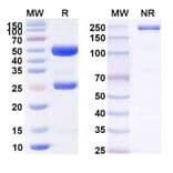 SDS-PAGE - Anti-Axl Antibody [ORY12] Biosimilar - BSA and Azide free (A339355) - Antibodies.com