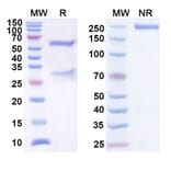 SDS-PAGE - Anti-B7-H3 Antibody [DS-5573a] Biosimilar - BSA and Azide free (A339356) - Antibodies.com