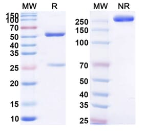 SDS-PAGE - Anti-C5 Antibody [MEDI7814] Biosimilar - BSA and Azide free (A339378) - Antibodies.com