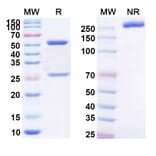 SDS-PAGE - Anti-MUC16 Antibody [RG7882] Biosimilar - BSA and Azide free (A339382) - Antibodies.com