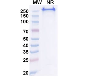 SDS-PAGE - Anti-CA9 Antibody [BAY 79462] Biosimilar - BSA and Azide free (A339384) - Antibodies.com