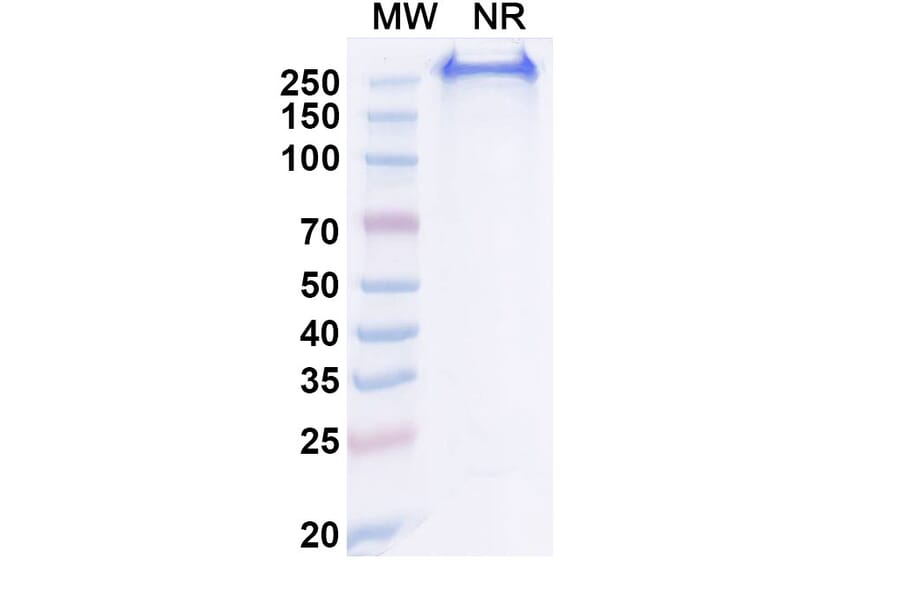 SDS-PAGE - Anti-CA9 Antibody [BAY 79462] Biosimilar - BSA and Azide free (A339384) - Antibodies.com