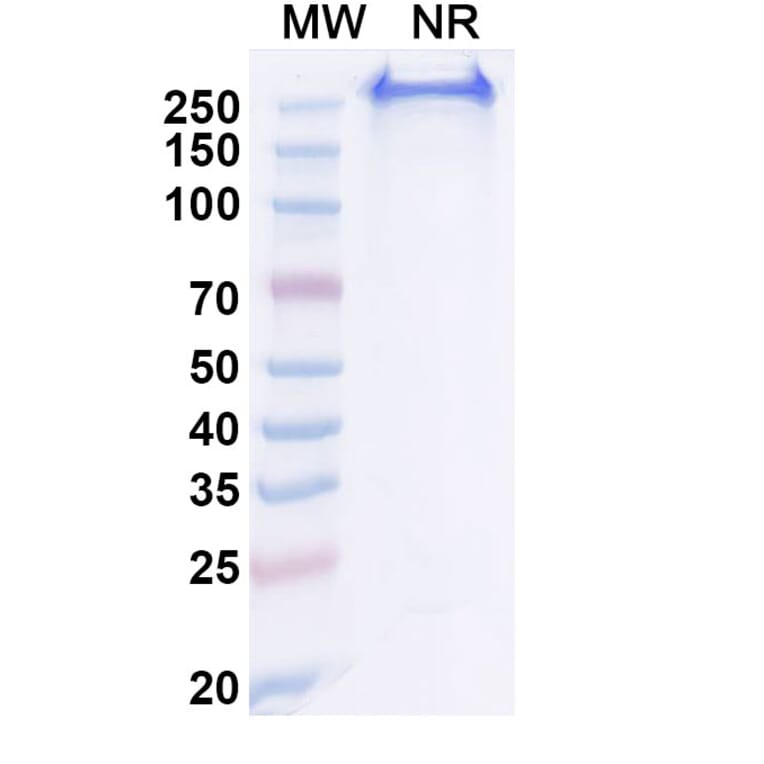 SDS-PAGE - Anti-CA9 Antibody [BAY 79462] Biosimilar - BSA and Azide free (A339384) - Antibodies.com