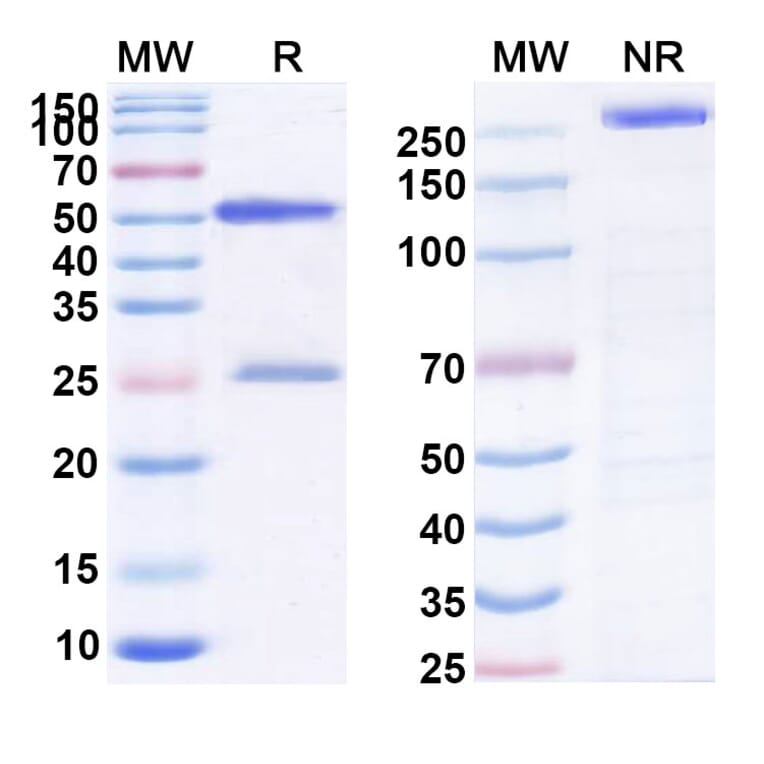 SDS-PAGE - Anti-CNOT6 Antibody [AT8] Biosimilar - BSA and Azide free (A339389) - Antibodies.com