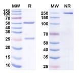 SDS-PAGE - Anti-CD19 Antibody [VB119] Biosimilar - BSA and Azide free (A339407) - Antibodies.com