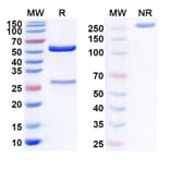 SDS-PAGE - Anti-CD19 Antibody [CYAD-4] Biosimilar - BSA and Azide free (A339409) - Antibodies.com