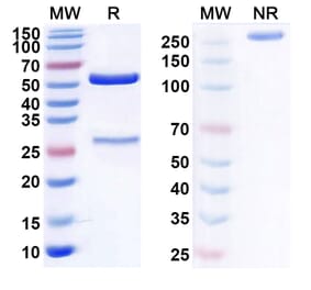 SDS-PAGE - Anti-CD19 Antibody [GBR 41] Biosimilar - BSA and Azide free (A339410) - Antibodies.com