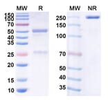 SDS-PAGE - Anti-CD19 Antibody [NKX19] Biosimilar - BSA and Azide free (A339419) - Antibodies.com