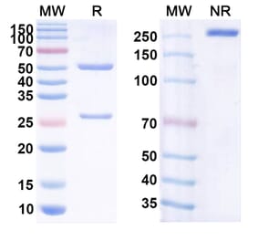 SDS-PAGE - Anti-CD20 Antibody [CHO-H1] Biosimilar - BSA and Azide free (A339424) - Antibodies.com