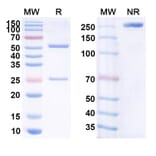 SDS-PAGE - Anti-CD20 Antibody [BVX2] Biosimilar - BSA and Azide free (A339428) - Antibodies.com