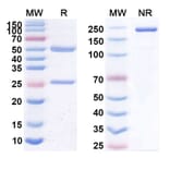 SDS-PAGE - Anti-CD20 Antibody [EDC9] Biosimilar - BSA and Azide free (A339432) - Antibodies.com