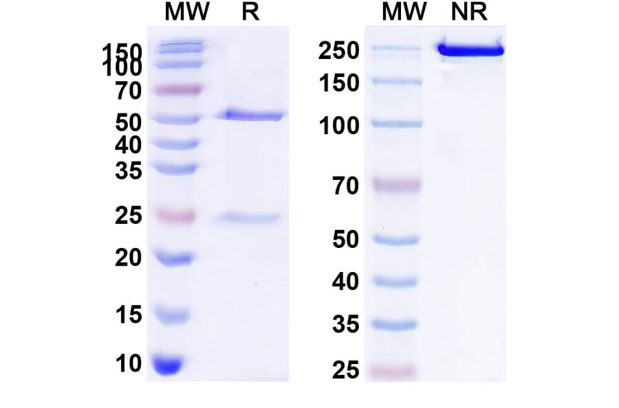 Chromatography profile - Anti-CD20 Antibody [MT-3724] Biosimilar - BSA and Azide free (A339437) - Antibodies.com