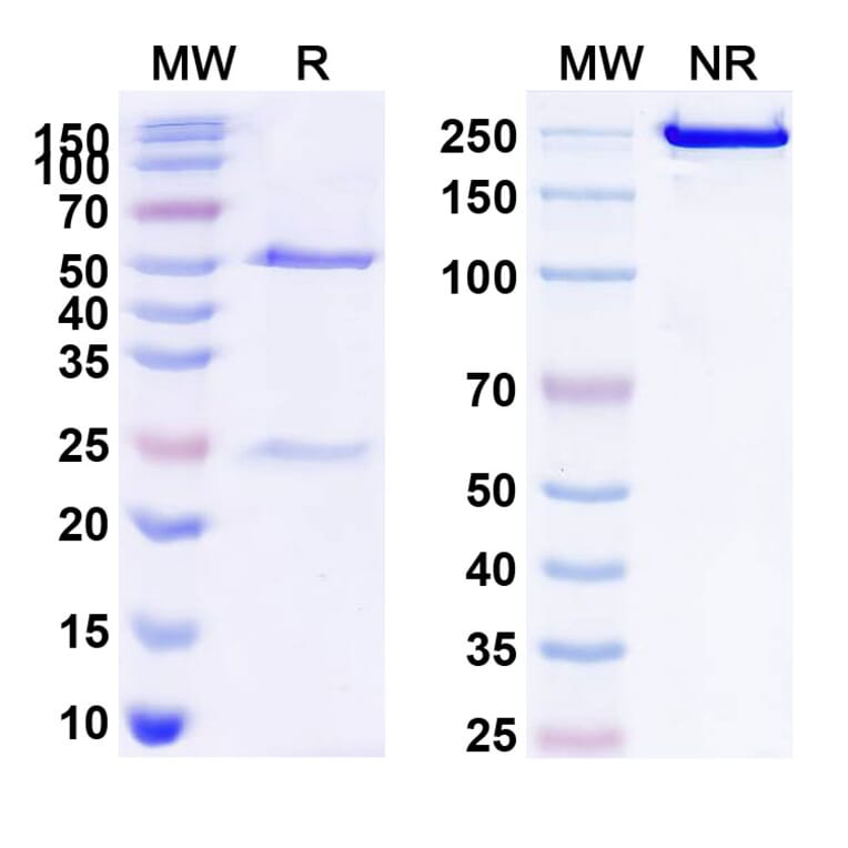 Chromatography profile - Anti-CD20 Antibody [MT-3724] Biosimilar - BSA and Azide free (A339437) - Antibodies.com