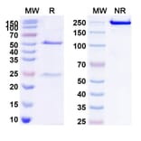 Chromatography profile - Anti-CD20 Antibody [MT-3724] Biosimilar - BSA and Azide free (A339437) - Antibodies.com