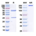 SDS-PAGE - Anti-CD20 Antibody [NAV6] Biosimilar - BSA and Azide free (A339439) - Antibodies.com