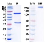 SDS-PAGE - Anti-CD20 Antibody [UB-923] Biosimilar - BSA and Azide free (A339442) - Antibodies.com