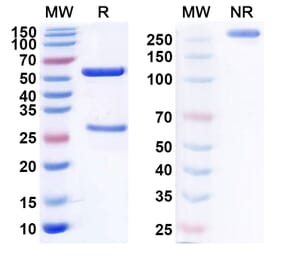 SDS-PAGE - Anti-CD22 Antibody [ADCT-62] Biosimilar - BSA and Azide free (A339444) - Antibodies.com