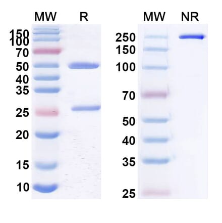 SDS-PAGE - Anti-CD22 Antibody [CAT-2-16] Biosimilar - BSA and Azide free (A339446) - Antibodies.com
