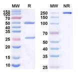 SDS-PAGE - Anti-CD22 Antibody [CAT-2-16] Biosimilar - BSA and Azide free (A339446) - Antibodies.com