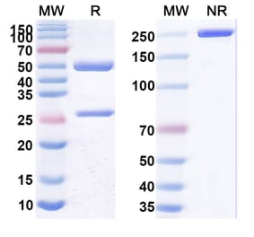 SDS-PAGE - Anti-CD22 Antibody [SM6] Biosimilar - BSA and Azide free (A339448) - Antibodies.com