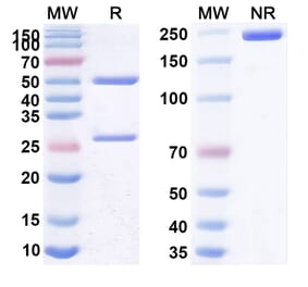 SDS-PAGE - Anti-CD25 Antibody [RA8] Biosimilar - BSA and Azide free (A339454) - Antibodies.com