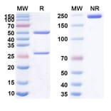 SDS-PAGE - Anti-CD25 Antibody [RA8] Biosimilar - BSA and Azide free (A339454) - Antibodies.com
