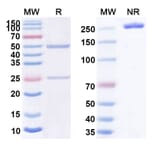 SDS-PAGE - Anti-CD30 Antibody [HeFi-1] Biosimilar - BSA and Azide free (A339460) - Antibodies.com