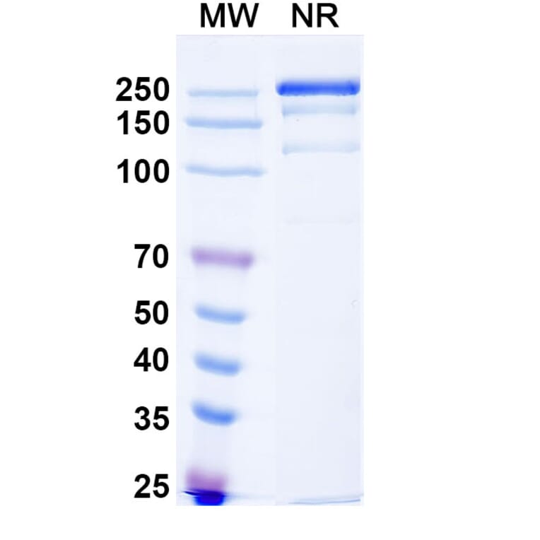 SDS-PAGE - Anti-CD32B Antibody [BI-167] Biosimilar - BSA and Azide free (A339464) - Antibodies.com