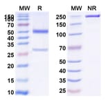 SDS-PAGE - Anti-CD39 Antibody [ES2] Biosimilar - BSA and Azide free (A339486) - Antibodies.com