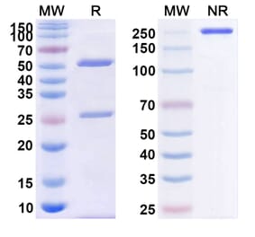 SDS-PAGE - Anti-CD39 Antibody [PUR1] Biosimilar - BSA and Azide free (A339487) - Antibodies.com