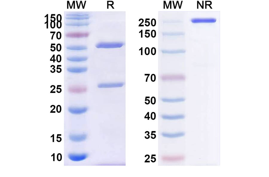 SDS-PAGE - Anti-CD39 Antibody [PUR1] Biosimilar - BSA and Azide free (A339487) - Antibodies.com