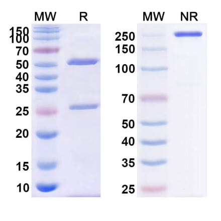 SDS-PAGE - Anti-CD39 Antibody [PUR1] Biosimilar - BSA and Azide free (A339487) - Antibodies.com