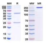 SDS-PAGE - Anti-CD40 Antibody [BI 65564] Biosimilar - BSA and Azide free (A339494) - Antibodies.com