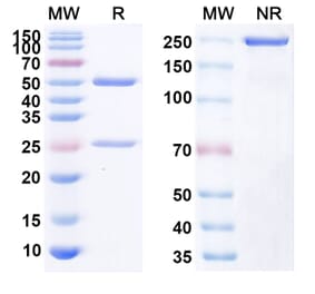 SDS-PAGE - Anti-Human CD40 [XmAb 5485] Biosimilar - Anti-CD40 Antibody - BSA and Azide free (A339506) - Antibodies.com