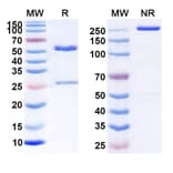 SDS-PAGE - Anti-CD47 Antibody [ZL-121] Biosimilar - BSA and Azide free (A339535) - Antibodies.com