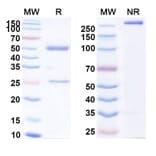 SDS-PAGE - Anti-CD98 Antibody [IGN523] Biosimilar - BSA and Azide free (A339551) - Antibodies.com