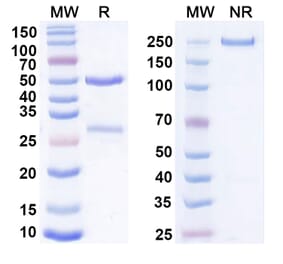 SDS-PAGE - Anti-Cadherin-6 Antibody [DS-6a] Biosimilar - BSA and Azide free (A339555) - Antibodies.com