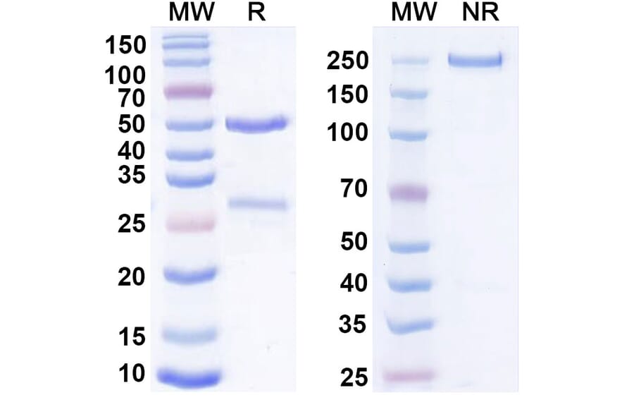 SDS-PAGE - Anti-Cadherin-6 Antibody [DS-6a] Biosimilar - BSA and Azide free (A339555) - Antibodies.com