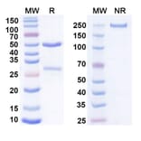 SDS-PAGE - Anti-Cadherin-6 Antibody [DS-6a] Biosimilar - BSA and Azide free (A339555) - Antibodies.com