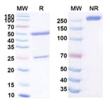 SDS-PAGE - Anti-CEA Antibody [16C3] Biosimilar - BSA and Azide free (A339560) - Antibodies.com