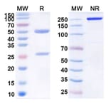 SDS-PAGE - Anti-Claudin 18 Antibody [BC8] Biosimilar - BSA and Azide free (A339571) - Antibodies.com