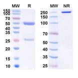 SDS-PAGE - Anti-Claudin 18 Antibody [GB74-9] Biosimilar - BSA and Azide free (A339573) - Antibodies.com