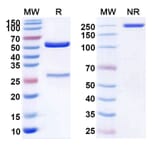 SDS-PAGE - Anti-c-Met Antibody [ABBV-4] Biosimilar - BSA and Azide free (A339583) - Antibodies.com