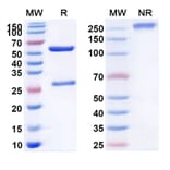 SDS-PAGE - Anti-c-Met Antibody [REGN593] Biosimilar - BSA and Azide free (A339588) - Antibodies.com