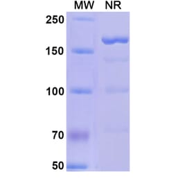 SDS-PAGE - Alefacept Biosimilar - Anti-CD2 Antibody - BSA and Azide free (A339598) - Antibodies.com