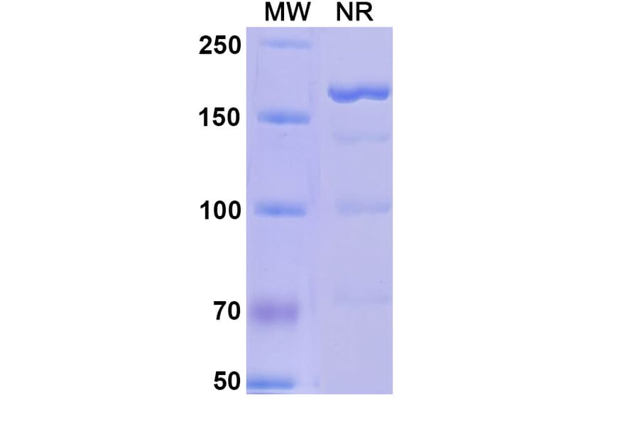 SDS-PAGE - Alefacept Biosimilar - Anti-CD2 Antibody - BSA and Azide free (A339598) - Antibodies.com